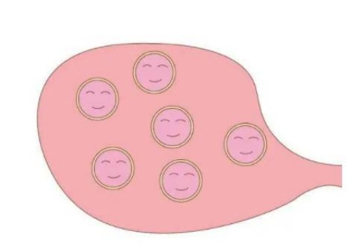 寧波助孕：痛經膏藥不是貼在哪里都能有效果的，貼對位置才能效果翻倍